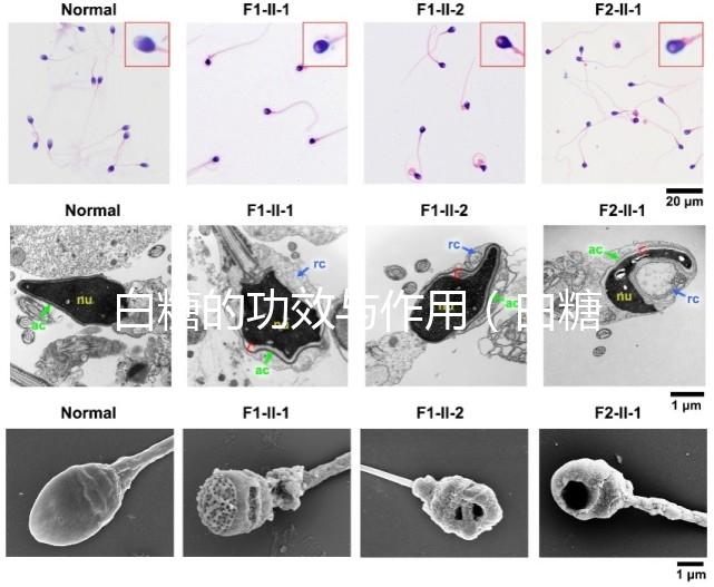 白糖的功效與作用（白糖的功效與作用及營養價值）