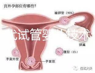 第一代試管嬰兒技術全解析：流程、適應癥及優缺點指南