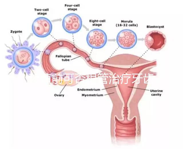 移植前可否根管治療牙齒看情況，這些影響別還不知道