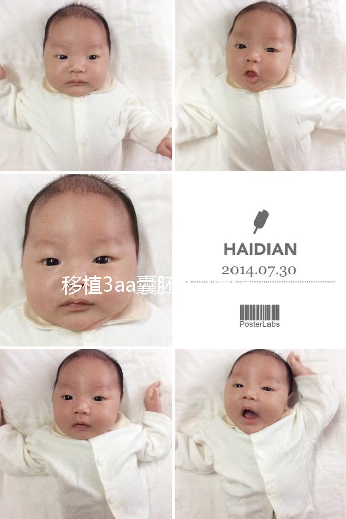 移植3aa囊胚成功率高嗎？詳解質量等級助孕更放心