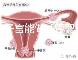 雙角子宮能做試管嬰兒?jiǎn)幔靠梢裕@2大條件缺一不可