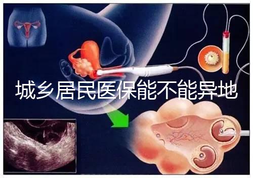 城鄉居民醫保能不能異地試管報銷？詳解2025試管醫保異地報銷的流程