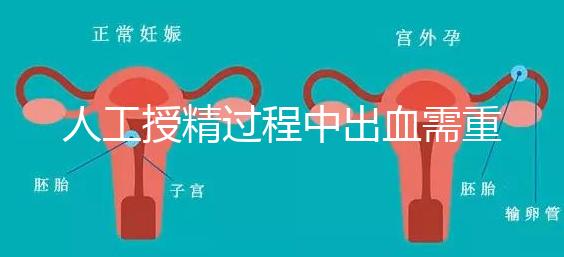 人工授精過程中出血需重視！這3種情況會影響成功率