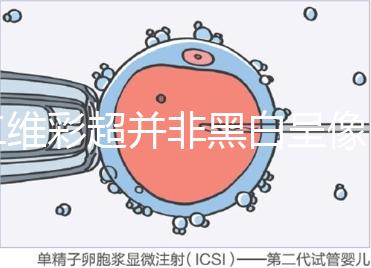 二維彩超并非黑白呈像，通過檢查還能看清胎兒五官