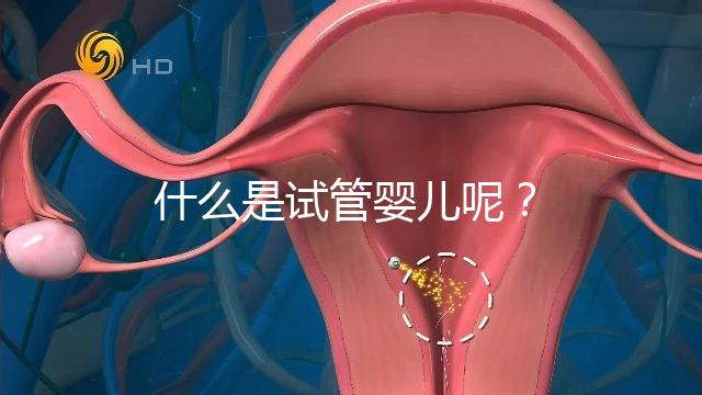 什么是試管嬰兒呢？