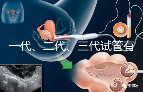 一代、二代、三代試管有什么區別？