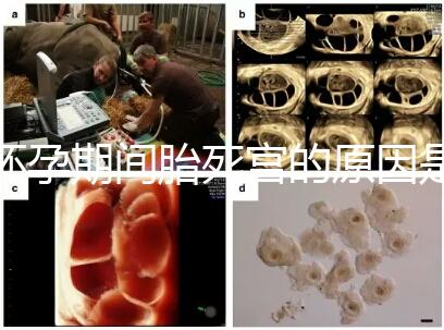 懷孕期間胎死宮的原因是什么？