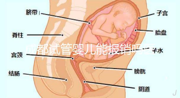 成都試管嬰兒能報銷嗎醫保？政策解讀