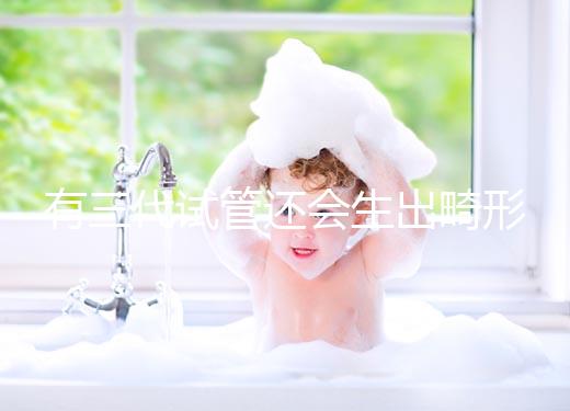 有三代試管還會(huì)生出畸形兒嗎