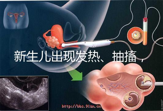 新生兒出現(xiàn)發(fā)熱、抽搐，很可能是胎毒的表現(xiàn)