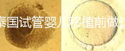 泰國(guó)試管嬰兒移植前做這3件事能提高成功率，不然會(huì)后悔！