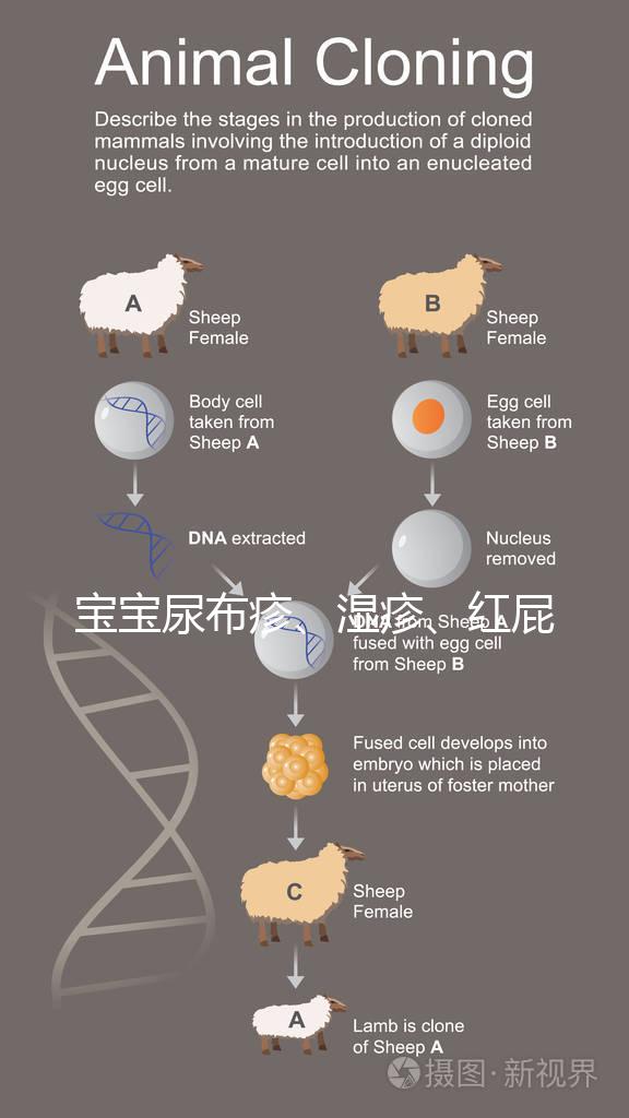 寶寶尿布疹、濕疹、紅屁股傻傻分不清?4點(diǎn)區(qū)別輕松診斷