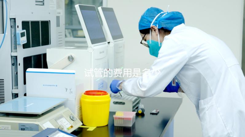 試管的費(fèi)用是多少