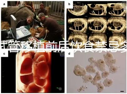 試管移植前后飲食禁忌多，十大不利于胚胎著床的水果別亂吃