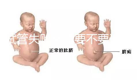 試管失敗離婚要不要退彩禮揭秘，三金怎么處理？