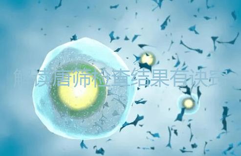 解讀唐篩檢查結(jié)果有訣竅，會看報告單上的正常值范圍是關(guān)鍵