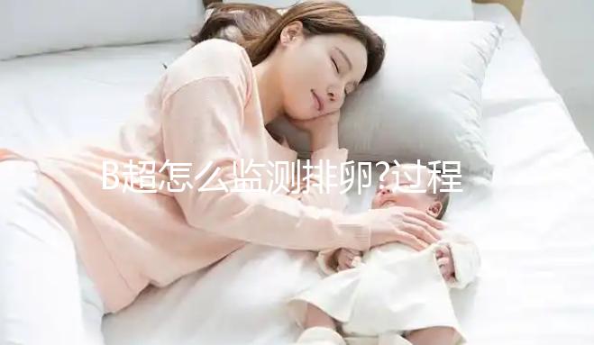 B超怎么監測排卵?過程中的這些小細節你一定要了解