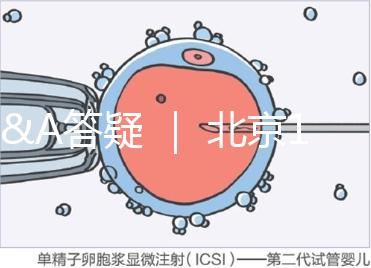 Q&A答疑 ｜ 北京16項輔助生殖技術進醫保，試管可以報銷嗎？