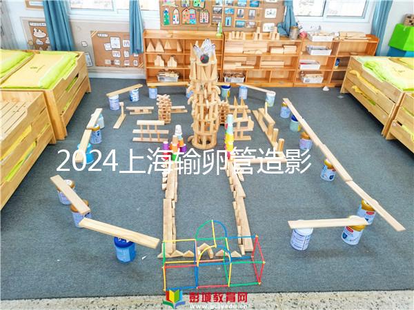 2024上海輸卵管造影檢查多少錢速覽，關鍵看能否報銷
